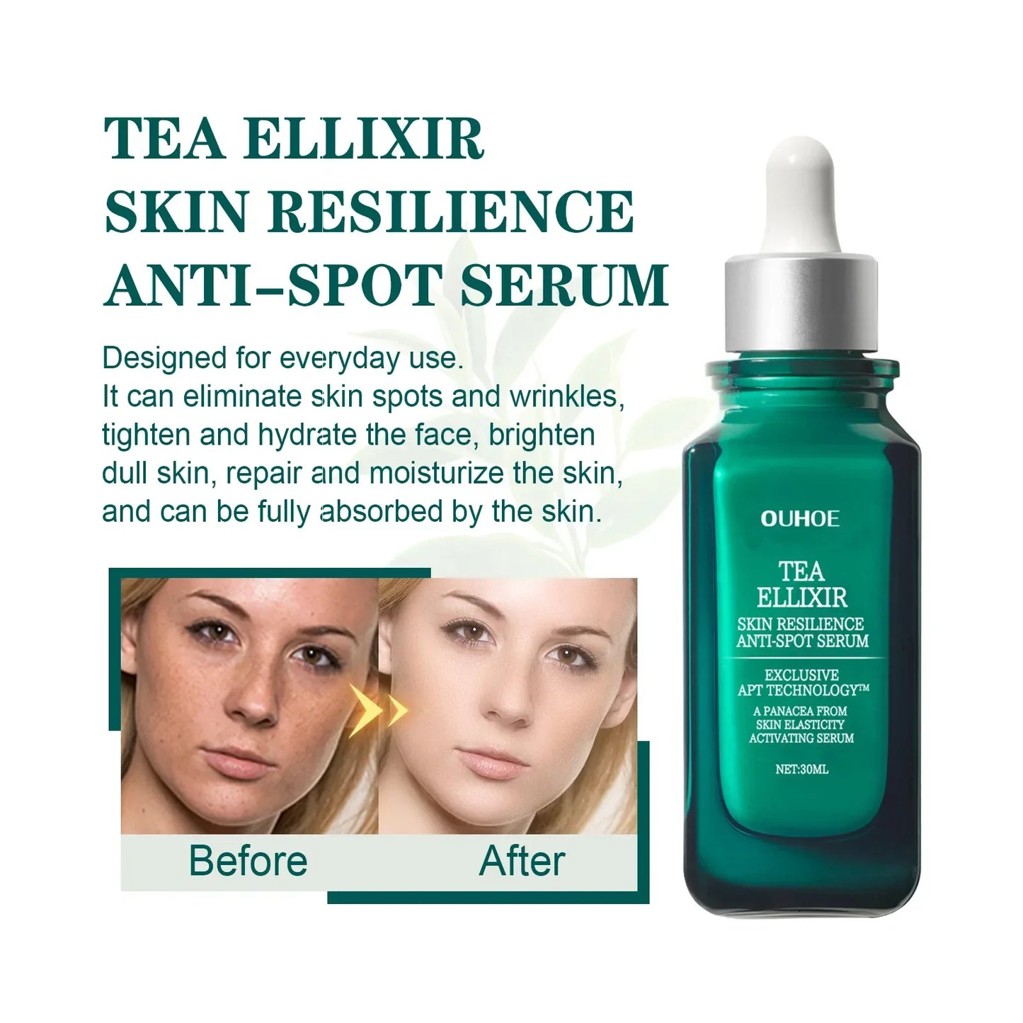 Skin Brightening  Serum Dark Spot Corrector Whitening Serum for Dark Skin Lightening Pigmentation Face Freckle Remover