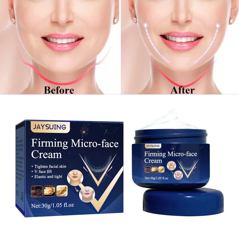 V Shape Slimming Cream Removal Double Chin Firming Tighten Mandibular Line Slimming Masseter Face Muscle Fat Burning Cream